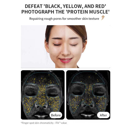 LED Photon Skin Rejuvenation Device with Face Mask