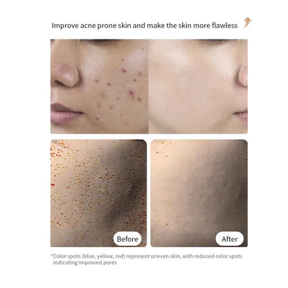 LED Photon Skin Rejuvenation Device with Face Mask